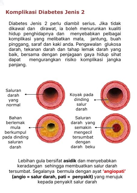 Komplikasi Diabetes Jenis 2