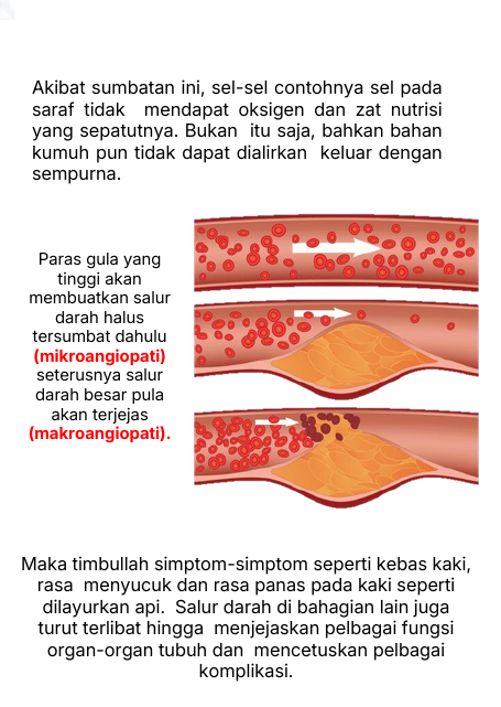 Mikroangiopati dan Makroangiopati