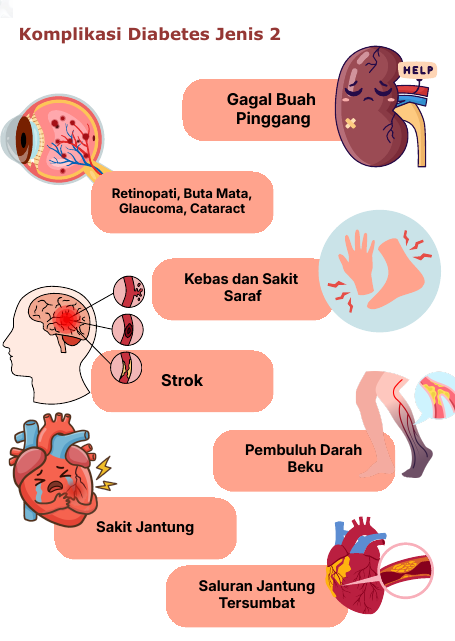 Ringkasan Komplikasi Diabetes Jenis 2