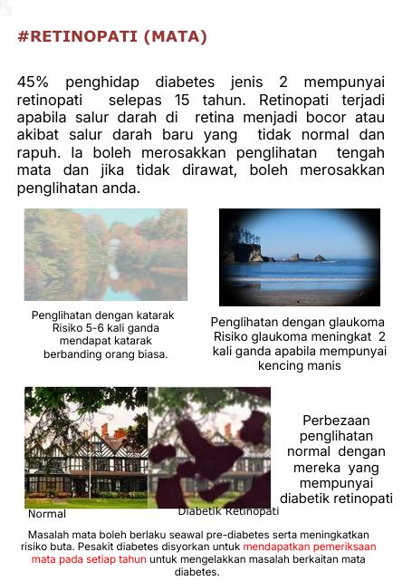 Retinopati (Mata)